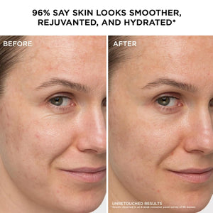 Before and after results of IT Cosmetics Confidence in a Cream showing smoother hydrated skin and visible wrinkle reduction