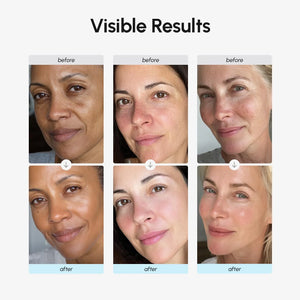 Before and after comparison showing improved skin texture and hydration after using MAREE Collagen & Retinol Moisturizer.