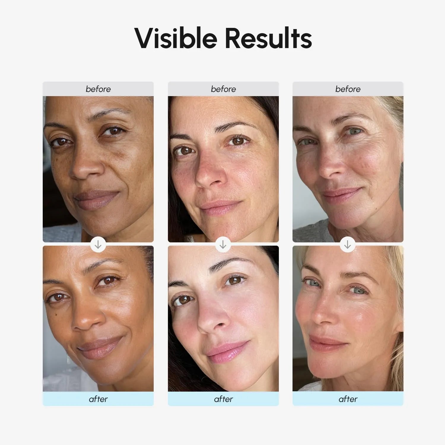 Before and after comparison showing improved skin texture and hydration after using MAREE Collagen & Retinol Moisturizer.