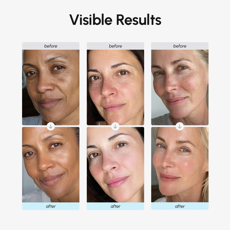 Before and after comparison showing improved skin texture and hydration after using MAREE Collagen & Retinol Moisturizer.