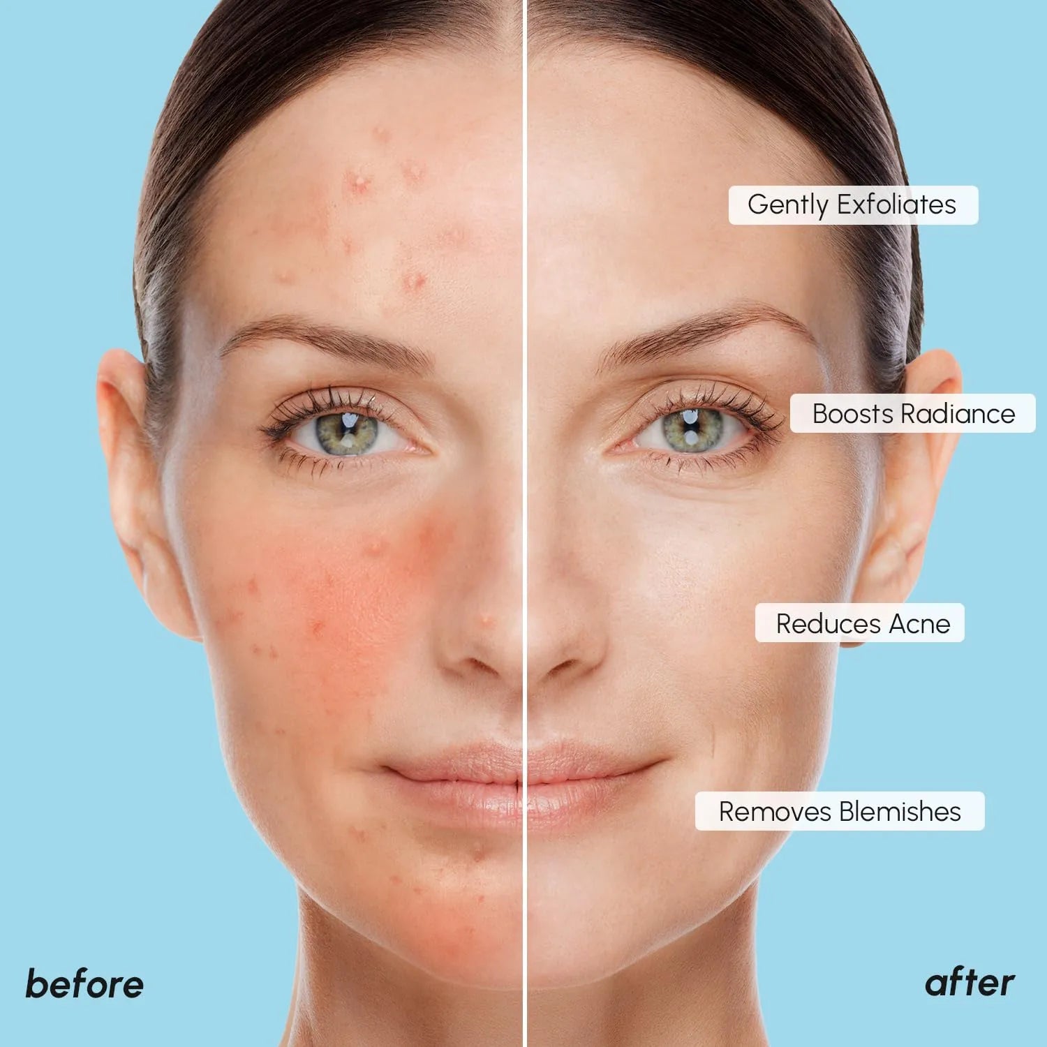 Before and after comparison showing smoother and clearer looking skin after using MAREE Glycolic Acid Facial Polish pads.