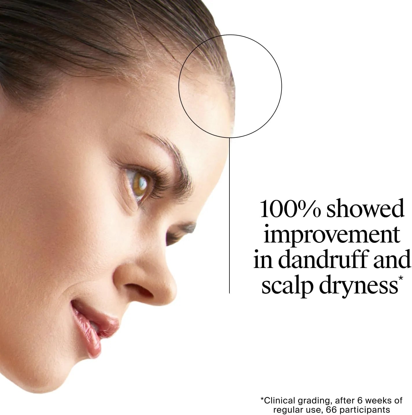 Close-up of woman’s scalp and hairline with Neutrogena T/Gel Scalp Relief Shampoo claim graphic.