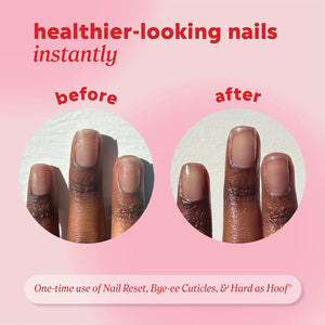 Before and after comparison of nails showing improved appearance after using Onyx Hard as Hoof Nail Strengthening Cream.