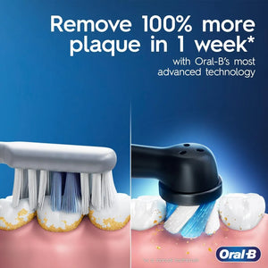 Comparison image showing electric toothbrush removing plaque versus manual toothbrush.